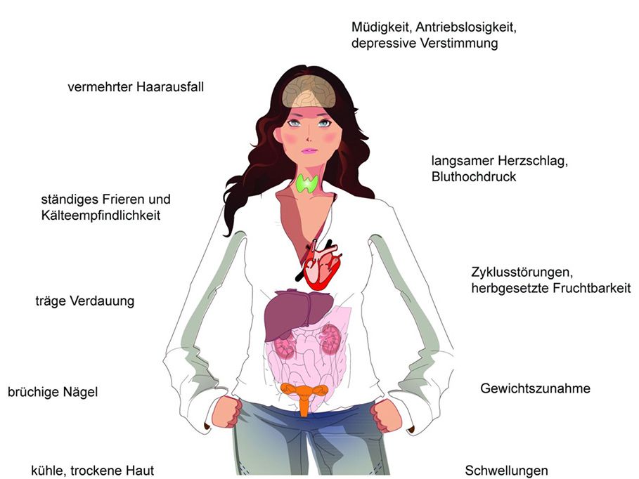 unterfunktion-schilddruese-symptome 1